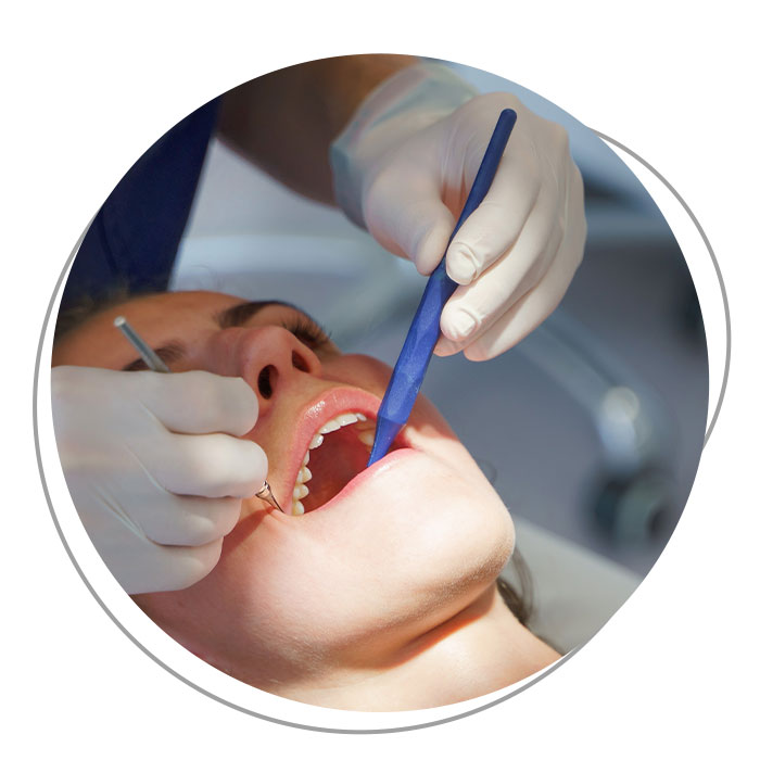 Igiene orale Parodontologia