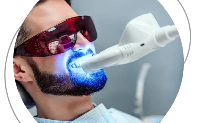 Lo Sbiancamento Dentale Domiciliare: Un Sorriso Più Bianco e Luminoso a Casa Tua