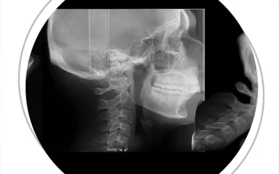 Neck Pain? Tension Headaches? Ear Issues? Here Are the Investigations for an Accurate Diagnosis.