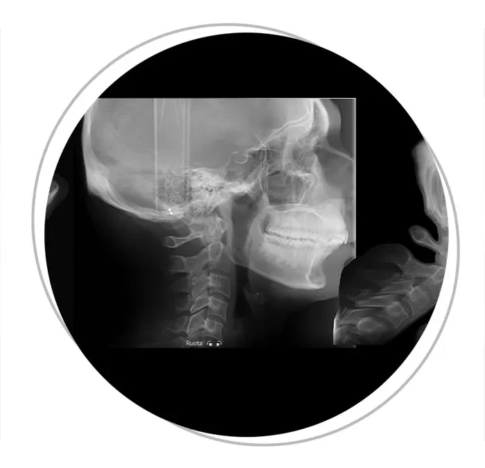 Neck Pain? Tension Headaches? Ear Issues? Here Are the Investigations for an Accurate Diagnosis.