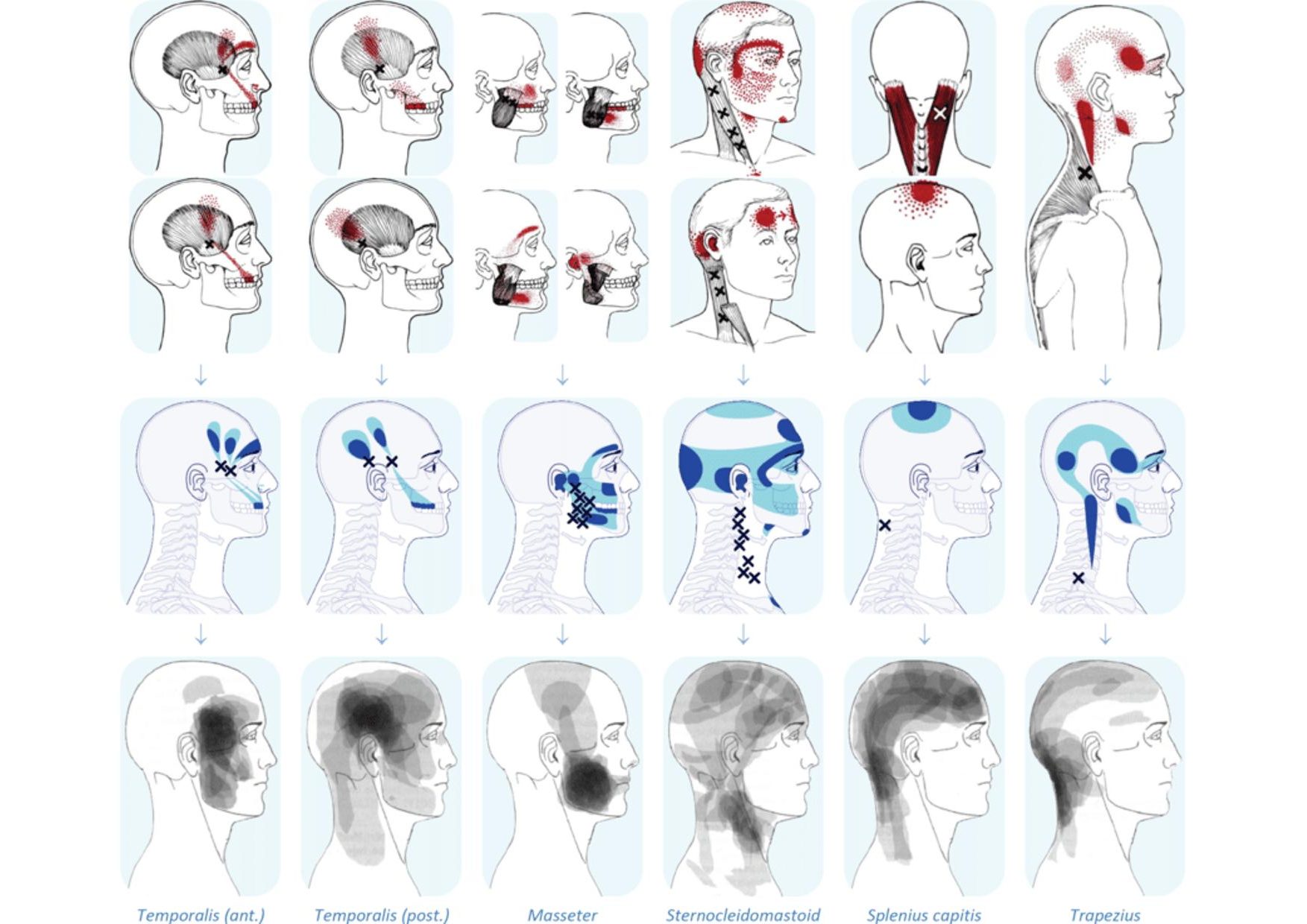 Mappa del dolore cranio faciale-1