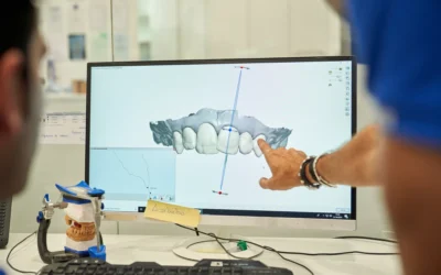 Implantologia Computer Guidata a Roma San Giovanni: Precisione, Sicurezza e Zero Sorprese