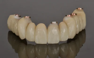 Denti Fissi in Un Giorno a Roma San Giovanni: è davvero possibile?