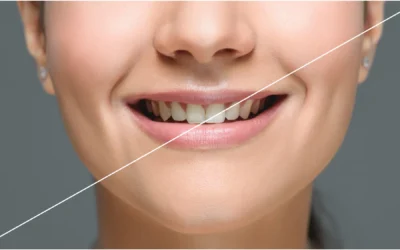 Migliorare l’estetica del sorriso a Roma: oggi puoi vedere il risultato prima di iniziare