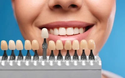 Faccette in ceramica senza limare i denti: mito o realtà?